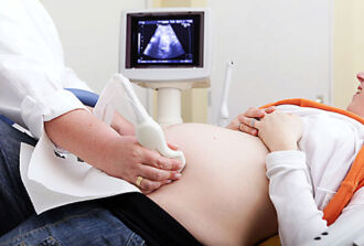 Bild einer Frau bei einem Ultraschalluntersuch